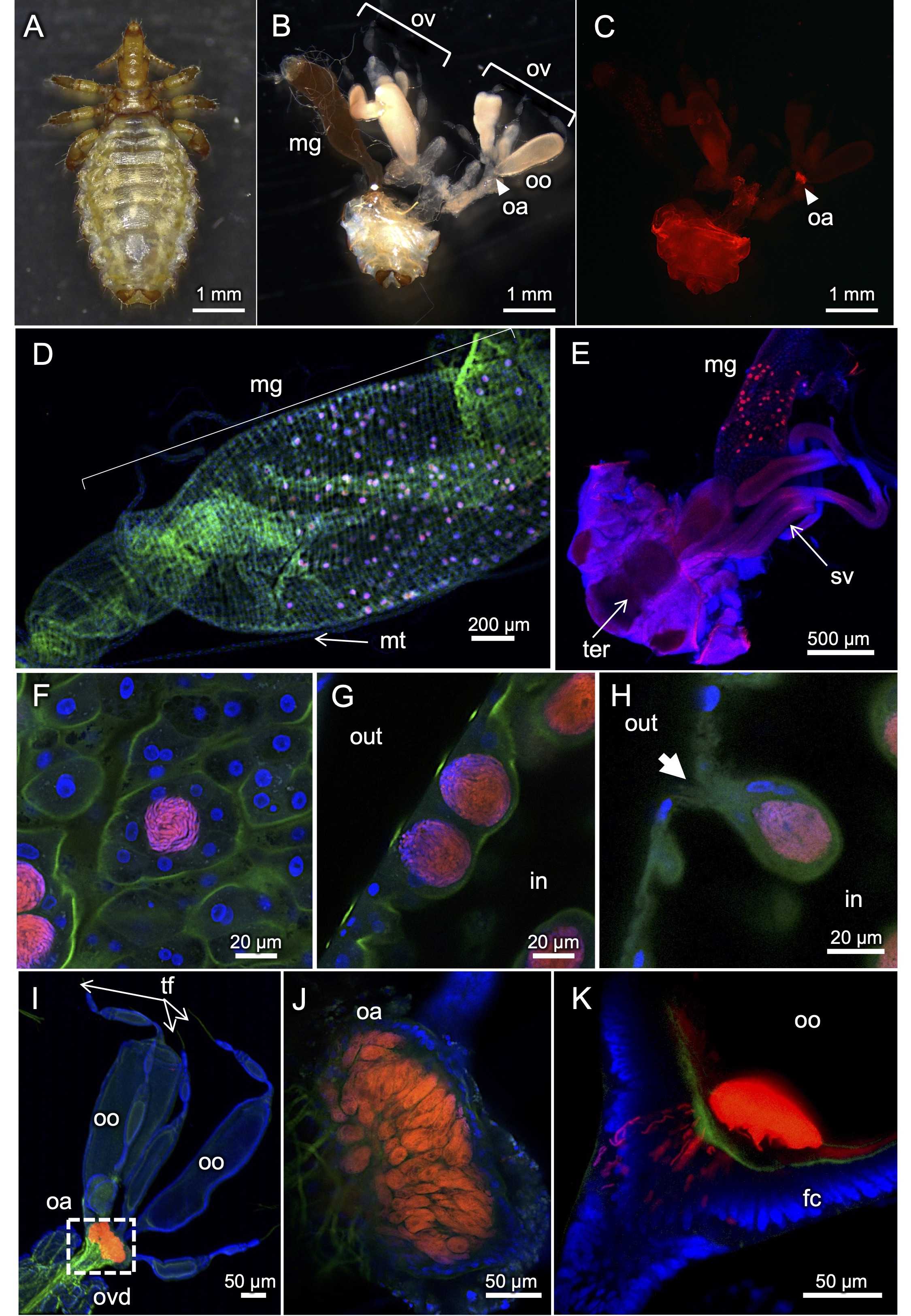 Endosymbiotic bacteria of the boar louse Haematopinus apri (Insecta: Phthiraptera: Anoplura)